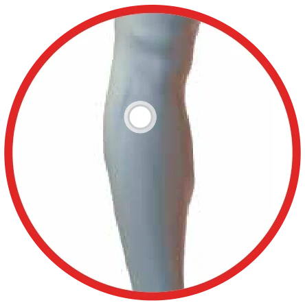 Dónde se coloca el parche Energy Enhancer: en la pierna, por debajo de la rodilla, hacia el lado externo